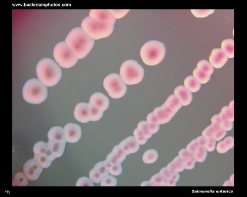 lactose negative colonies of salmonella on Endo